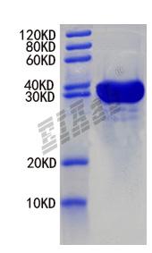 Human SLC26A5 Protein