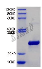 Mouse Ntn1 Protein