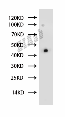 Human GSK3B Polyclonal Antibody