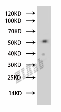 Human ADRB1 Polyclonal Antibody