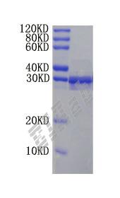 Human IRAK3 Protein