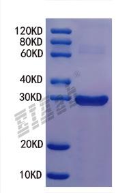 Human ADRB1 Protein
