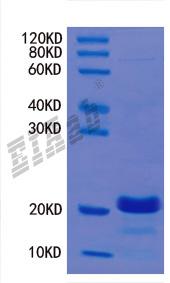 Human MKI67 Protein