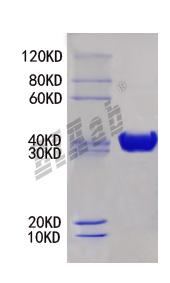 Mouse Alk Protein