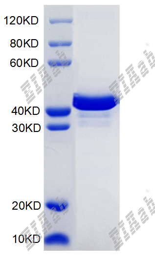 Human DNTTIP1 Protein