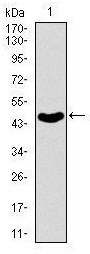 Human ABCB5 Monoclonal Antibody
