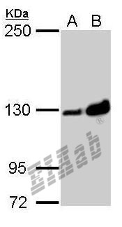 Vinculin antibody Rabbit Polyclonal Antibody