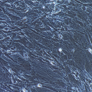 小鼠原代主动脉平滑肌细胞