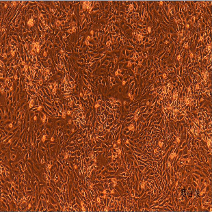 人原代子宫内膜上皮细胞