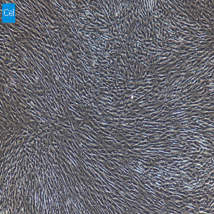 大鼠原代骨骼肌成纤维细胞