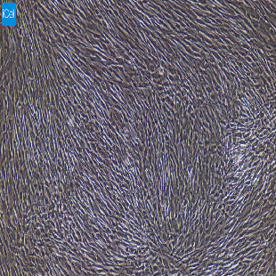 大鼠原代骨骼肌成纤维细胞