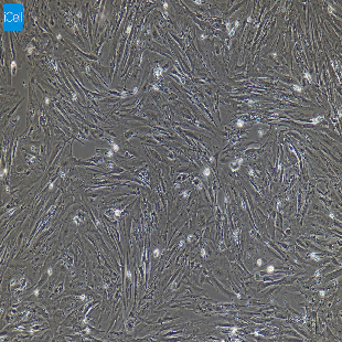 小鼠原代子宫平滑肌细胞