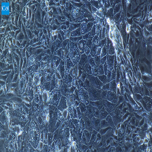 小鼠原代晶状体上皮细胞