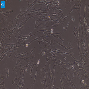 小鼠原代脉络膜微血管内皮细胞