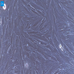 大鼠原代肺成纤维细胞