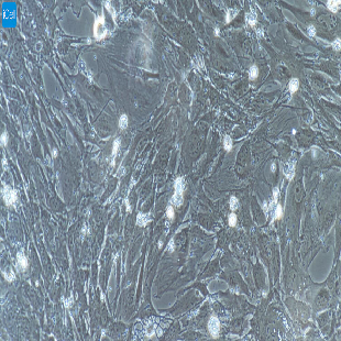 小鼠原代主动脉外膜成纤维细胞