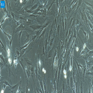 小鼠原代颈动脉内皮细胞
