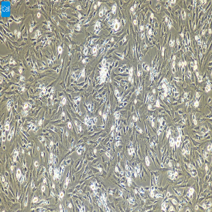 小鼠原代输尿管平滑肌细胞