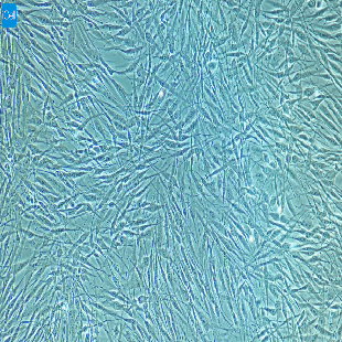 小鼠原代膀胱基质成纤维细胞