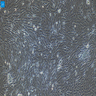 兔原代膀胱基质成纤维细胞