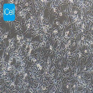 A172 人胶质母细胞瘤细胞