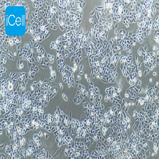 AN3CA人子宫内膜腺癌细胞（暂不提供）
