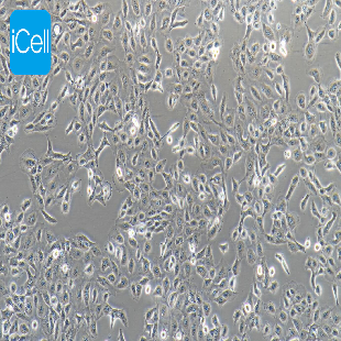DU145 人前列腺癌细胞