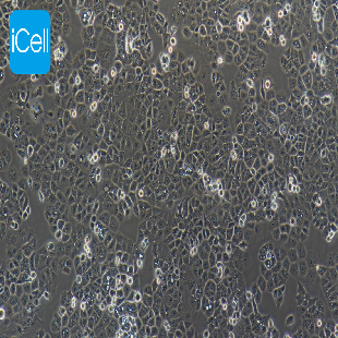 HEC-1-A 人子宫内膜腺癌细胞