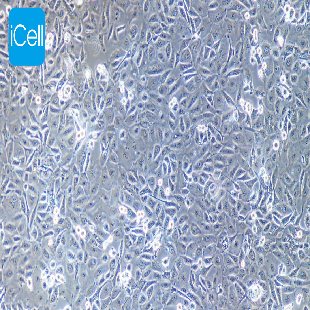 MDA-PCA-2B 人前列腺癌细胞（暂不提供）