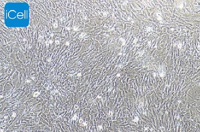 MEF 小鼠胚胎成纤维细胞 (丝裂霉素C处理)