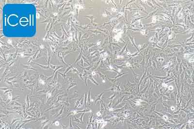 SNB-19 人胶质瘤细胞