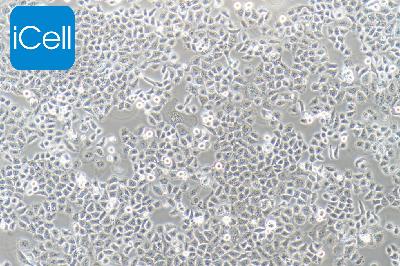 SMMC-7721 人肝癌细胞