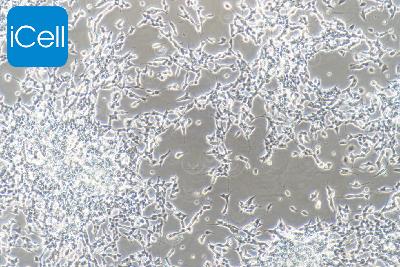 SH-SY5Y 人神经母细胞瘤细胞