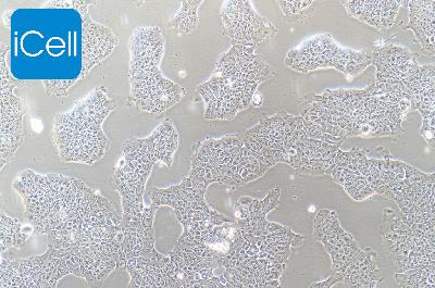 RT4 人膀胱移行细胞乳头瘤