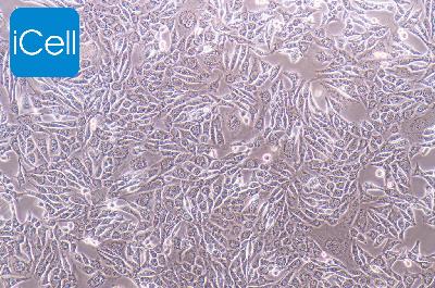 ID8 小鼠卵巢上皮癌细胞