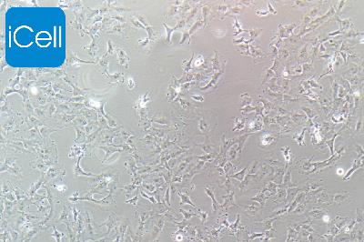 HS578T 人乳腺癌细胞