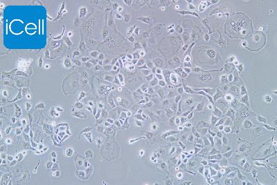 KLE 人子宫内膜癌细胞