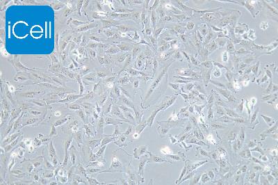 TJ905 人胶质瘤细胞