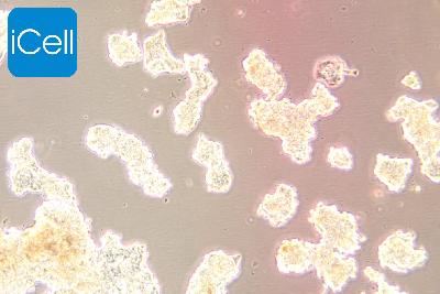ZR-75-1 人乳腺癌细胞