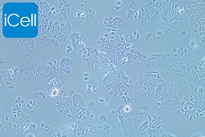 MDA-MB-415 人乳腺癌细胞