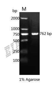 Human EPB41 Protein