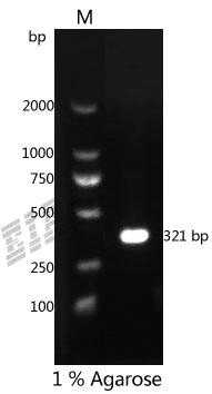 Human SPP1 Protein