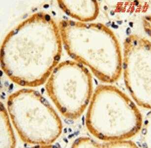 Human CASP2 Polyclonal Antibody