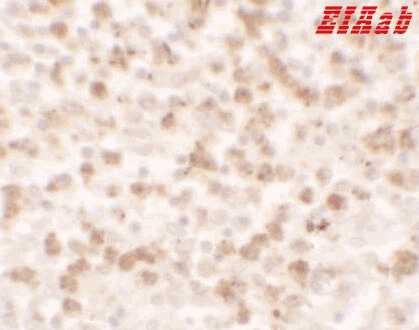 Human CCL17 Polyclonal Antibody