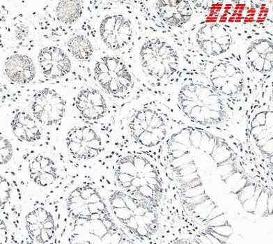 Human CCL25 Polyclonal Antibody