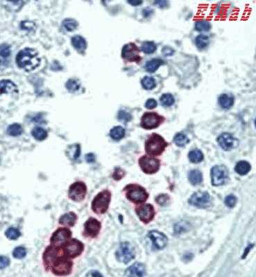 Human CCND1 Polyclonal Antibody