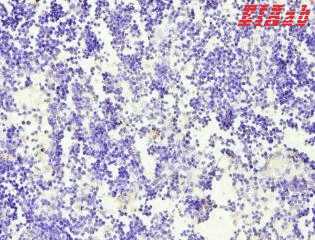 Human CD58 Polyclonal Antibody