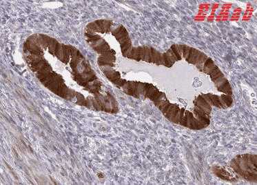 Human CMPK1 Polyclonal Antibody