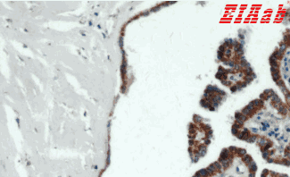 Human ECM1 Polyclonal Antibody