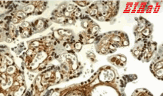 Human EDA Polyclonal Antibody